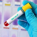 One hand holds a blood sample with inscription 'taken care off'
